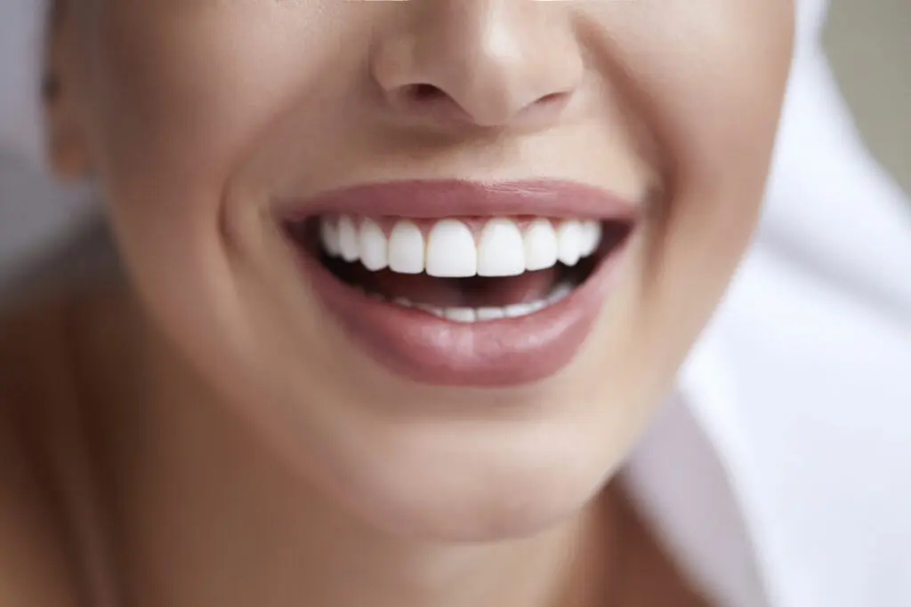 How Much Do Veneers Cost in Rogers, AR? 