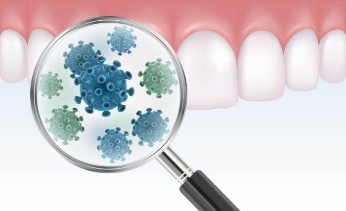 Why do my gums bleed when i brush my teeth 4 Bleeding Gums Rogers AR | Gum Disease | Gingivitis