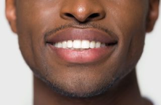 prevent tooth stains Rogers Arkansas