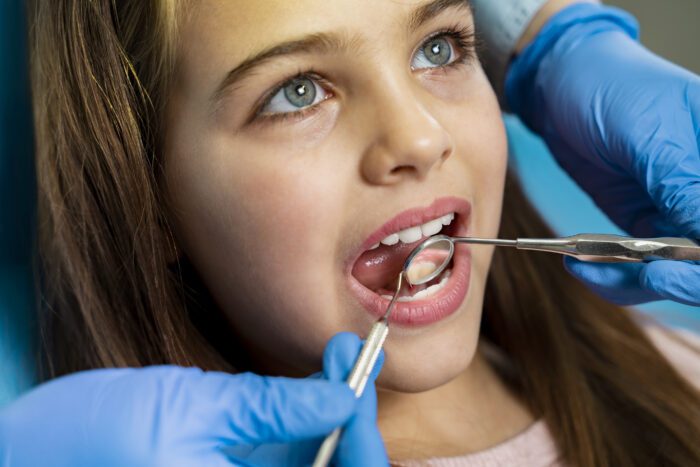 Tooth Extraction in Rogers, AR