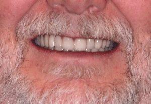 Dave-P-after-300x207