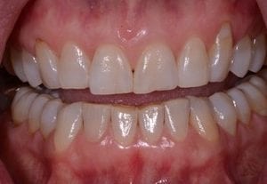 kelly-3-before-1-300×207 kelly-3-before-1-300x207