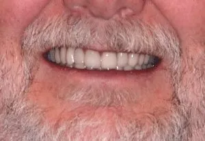 Dave-P-after-300x207-1