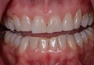 kelly-3-before-1-300x207-1