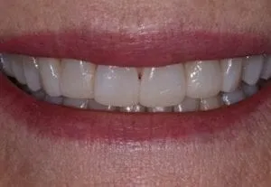 kelly-after-300x207-1